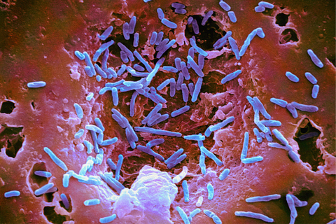 Microbiome