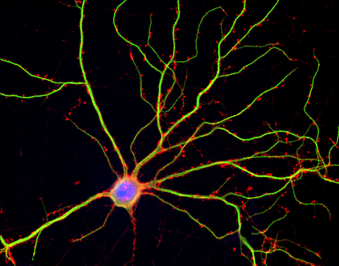 Mature neuron