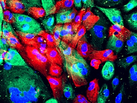 Xenograph model of wild type human prostate cells from an organoid (a man-made construct that resembles an organ).