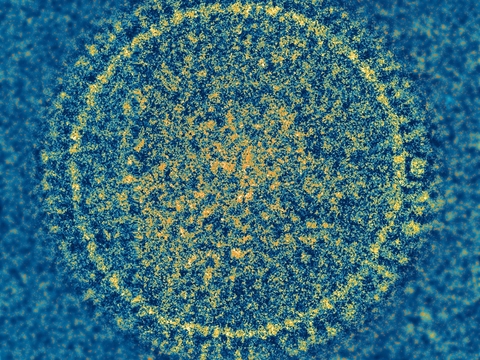 Respiratory Syncytial Virus--Courtesy of NIAID
