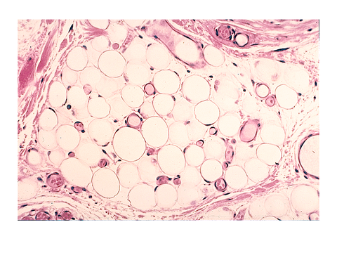 White adipose tissue