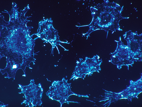 Cancer cells