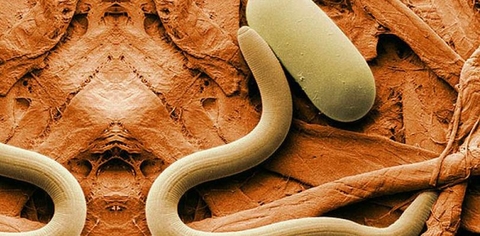 Roundworms