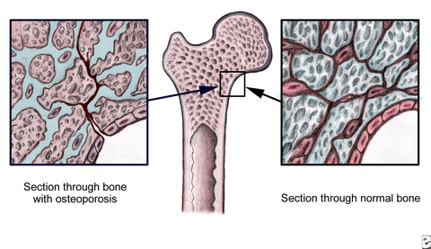 bone