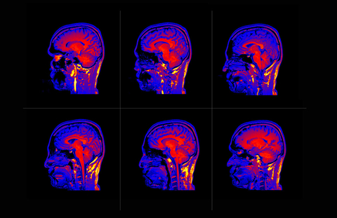 brain scans