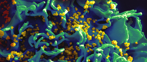 hiv