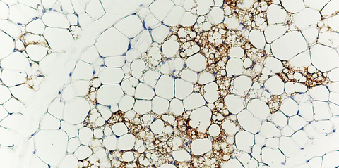 White fat cells