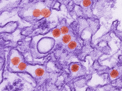 zika