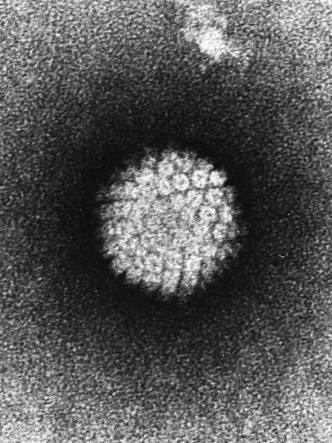 Human papilloma virus HPV