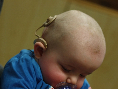 cochlear