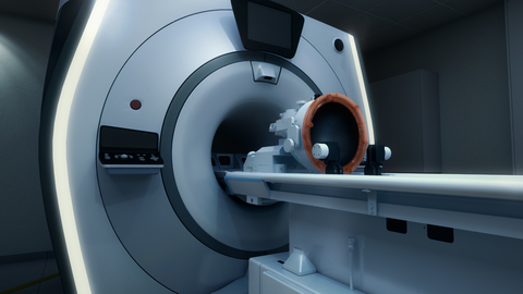 Exablate Neuro System