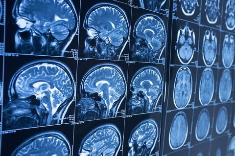 brain imaging brain imaging