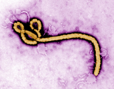 Ebola virus Ebola virus