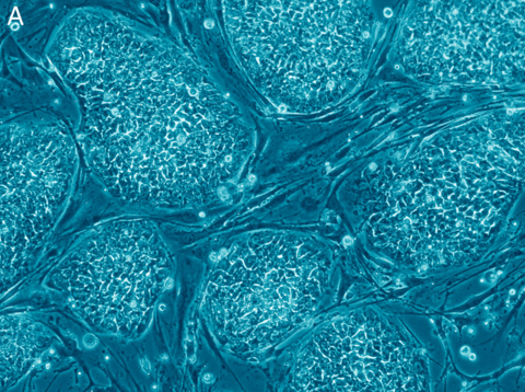 Human embryonic stem cells Human embryonic stem cells