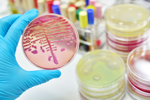 Bacteria culture lab gloved hand holding up bacteria culture