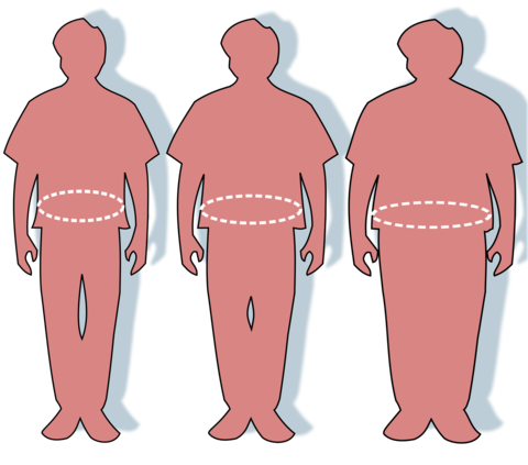 Obesity Obesity