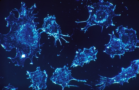 Cancer cells image Cancer cells image