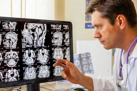 Researcher looking at brain images Researcher looking at brain images