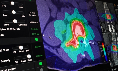 Brainlab elements radiosurgery planning image from elements spine surgery planning
