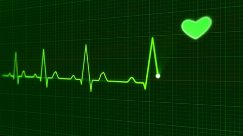 Heart monitor Heart monitor