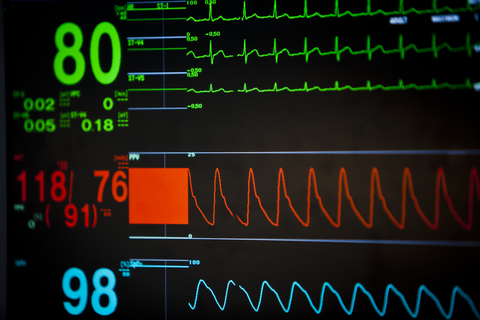Healthcare monitor vital signs alarm ICU CREDIT: Getty/boggy22 A close-up photo of a vital signs monitor