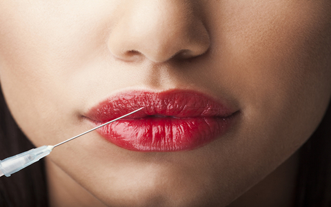 Botox Lips NikiLitov/iStock / Getty Images Plus Botox Lips NikiLitov/iStock / Getty Images Plus