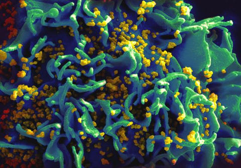 HIV infected T Cell h.i.v. infected t cell