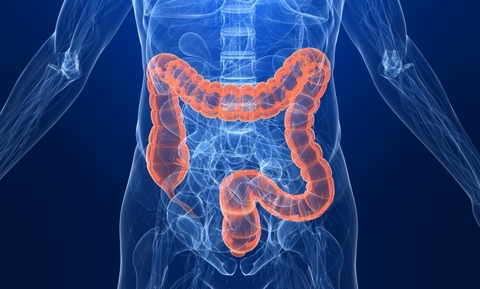 Colorectal colorectal