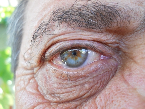 Old eye Old eye