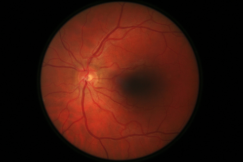 Retina retina scan