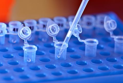 Test tubes Test tubes