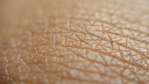 Skin closeup Skin closeup