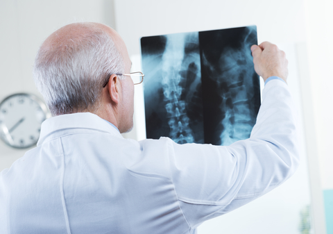 Spine x-ray (Credit: Getty/cyano66) doctor looking at x-ray of spine