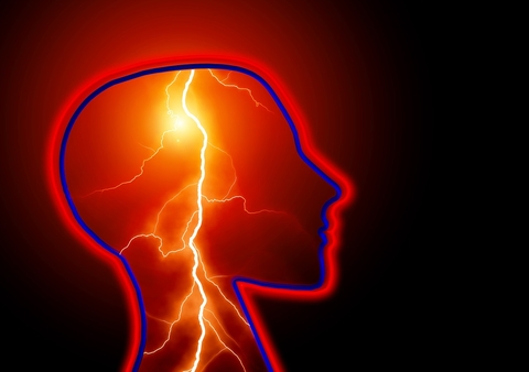 Migraine headache/epilepsy brain image Migraine headache/epilepsy brain image