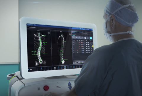 Mazor X A doctor using the Mazor X system