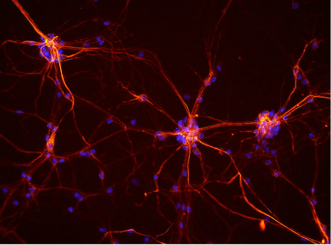 Mouse Neurons Mouse Neurons