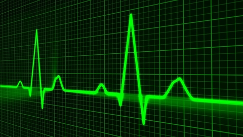 heartbeat EKG rhythm