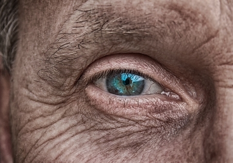 old eye eye