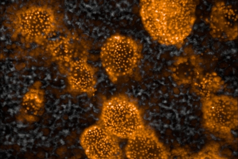 Liver tissue on scaffold Liver tissue on scaffold