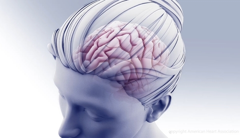 Head And Brain stroke head and brain
