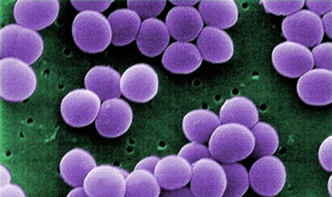 S aureus bacteria infection S. aureus infection