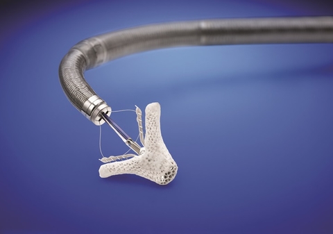 abbott mitraclip abbott mitraclip