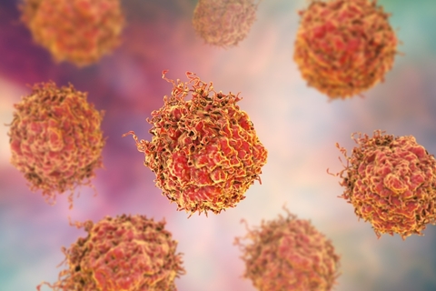 Prostate Cancer Prostate Cancer