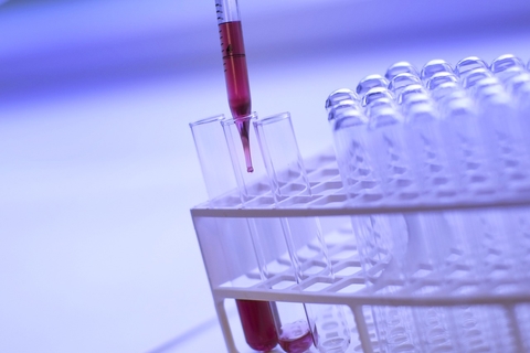 test tubes test tubes