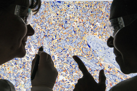 AstraZeneca - Investigation of protein expression Investigation of protein expression (Image: AstraZeneca)
