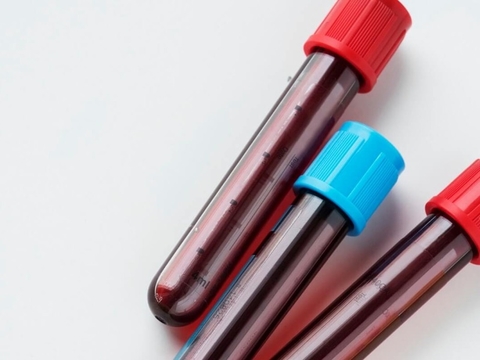 blood test tube blood sample