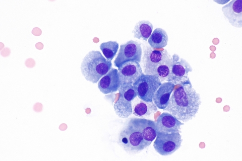 Macrophages Macrophages