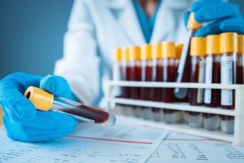 blood test blood test