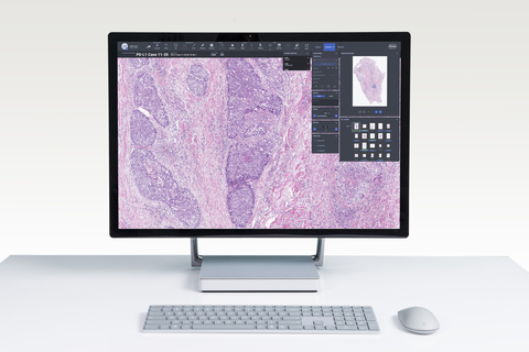 Roche digital pathology Roche digital pathology