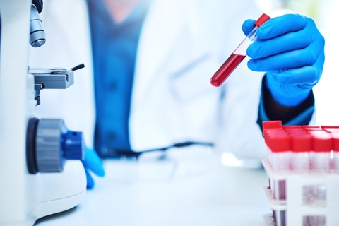 blood test tube blood test tube